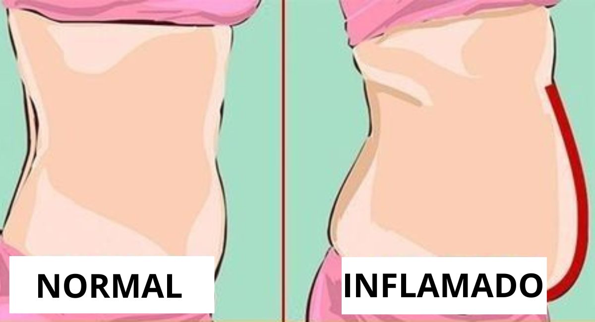 Cómo desinflamar el abdomen distendido en minutos